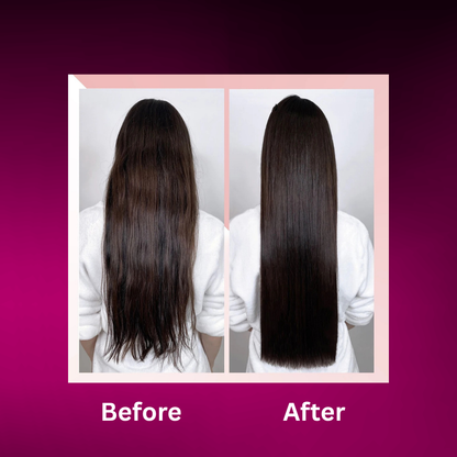 Yilest®™ Onion Hair Care Set